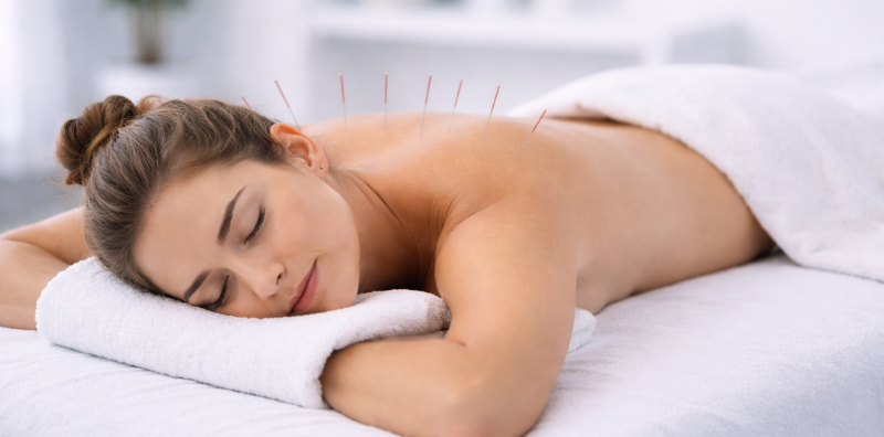 Client using Medical Acupuncture