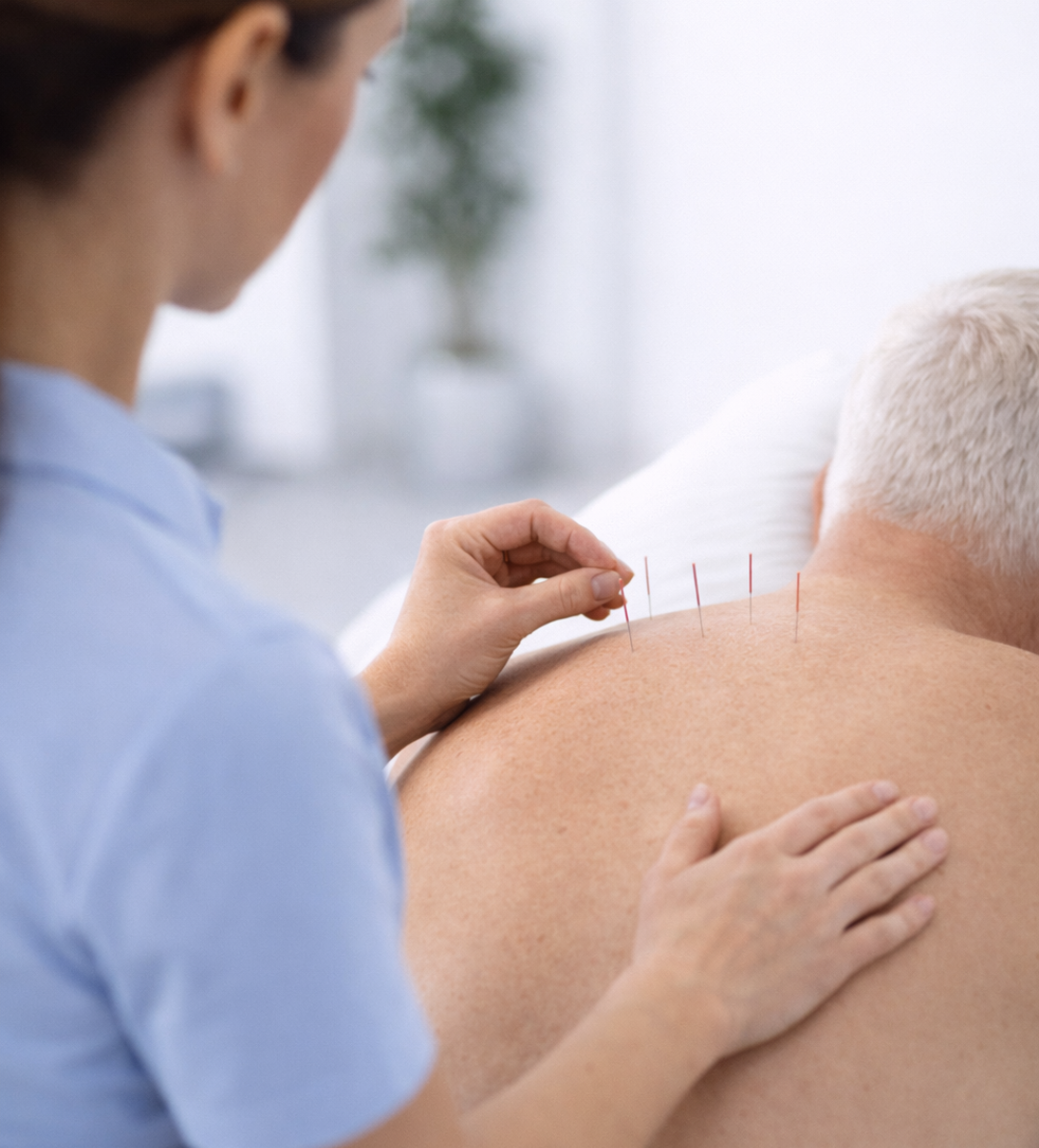 Staff doing Medical Acupuncture
